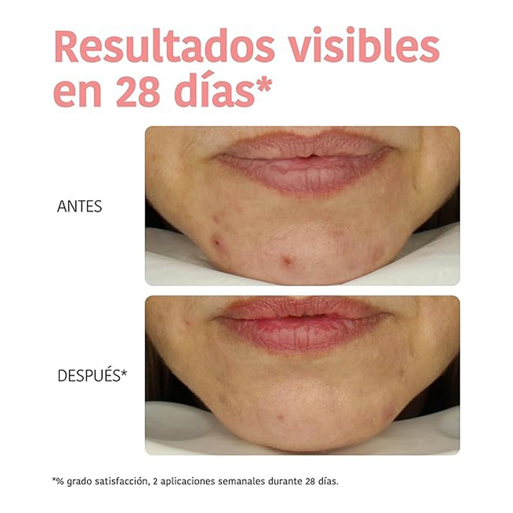 Mascarilla Facial Peeling Glycolic Acid Iroha - IROHA - Aldea Nativa